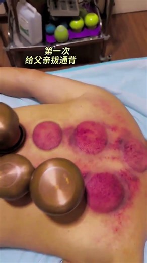 Hammer Therapy: Trending Stress Relief Technique