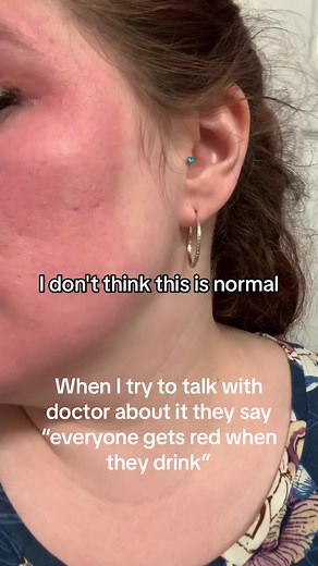 Understanding the Effects of Alcohol on Your Skin