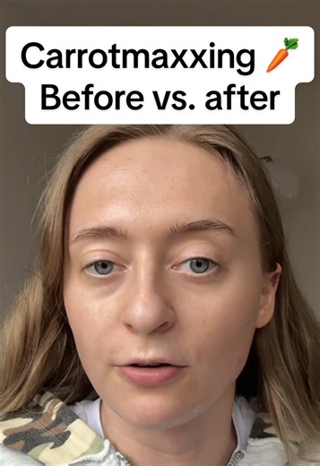 Carrot Juice Benefits for Tanning