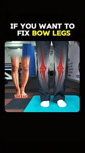 Do your knees curve outward when you stand? That’s called bow legs (genu varum) and it’s more common than you think. The good news? You don’t always need surgery. ✅ With the right bow legs correction approach, you can start reversing the pattern through science-backed movement. At FlexifyMe Physiotherapy, we focus on fixing the root cause: — Weak inner thigh muscles — Poor hip mobility — Lack of ankle and calf eversion — Faulty posture and leg alignment This is not just about how your legs look 