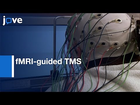 EEG Data Extraction during fMRI-guided TMS | Protocol Preview
