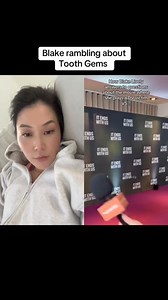 1.2K views | Blake Lively and tooth gems 醴 #toothgems #toothcrystals #toothart #dentist #smile #sparklesmile | JoycetheDentist | Facebook