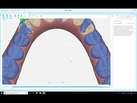 workshop clincheck pro