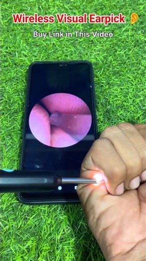 Wireless Visual Earpick Unboxing |Ear Wax Removing Machine Review & Unboxing #earwax