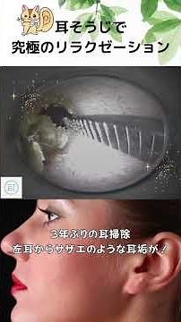 【衝撃】3年ぶりの耳掃除、左耳からサザエのような耳垢が！ #eariss luana #イヤーエステ #耳掃除 #eariss #イヤーエステ #耳掃除 #耳かき動画