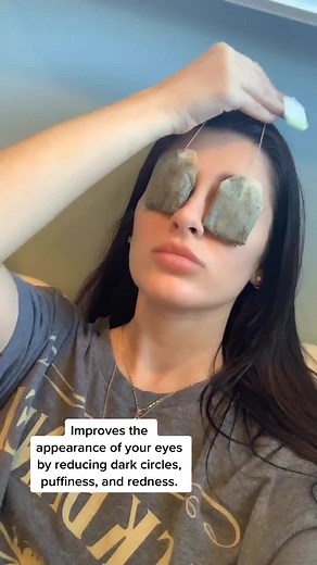 Reduce Eye Swelling with Tea Bag | At-Home Remedy