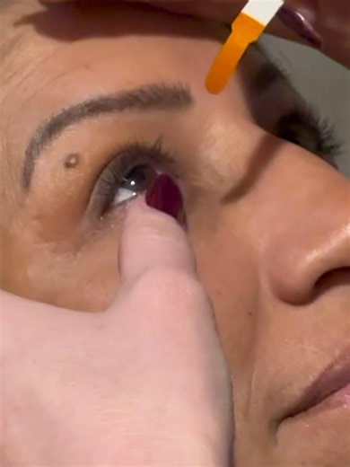 Understanding the Fluorescein Stain Test for Eye Health