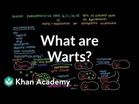 What are warts? | Infectious diseases | NCLEX-RN | Khan Academy