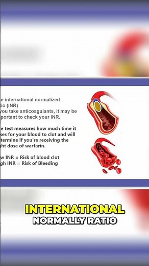 D-dimer and INR: Understanding Blood Clotting Tests #shorts