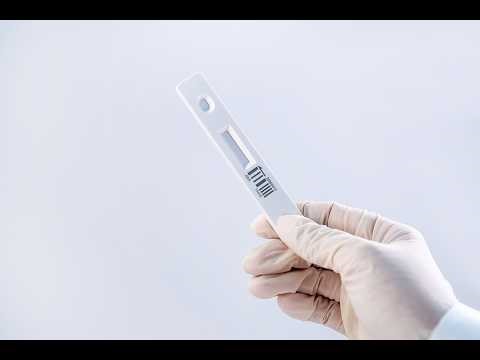 working principle of 15min ANA testing
