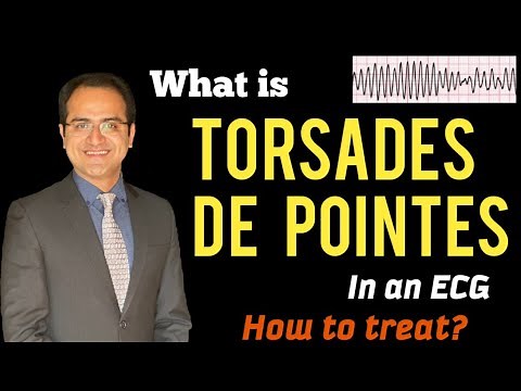 Torsades De Pointes ECG, Polymorphic Ventricular Tachycardia Treatment, ECG lectures USMLE, NCLEX