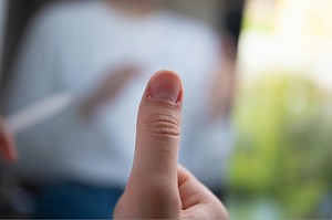 Doctor Explains What It Means If You Have Ridges On Your Fingernails