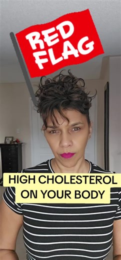 Do you see the warning signs on your body? it could be high cholesterol