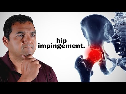 Hip Impingement: Causes, Symptoms, and Treatment Options