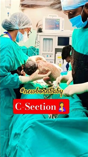 New born baby 👶||c-section baby born#lscs#csectionbirth#newborn#ytshorts#shortsfeed#shorts#delivery