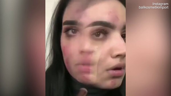 Women are praising this foundation for COMPLETELY covering acne