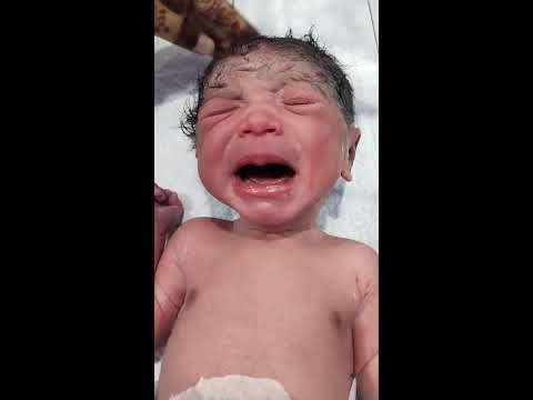 New Baby Born👶❤️Live Stream | baby reaction | babies live moments | nicu live baby activities | live