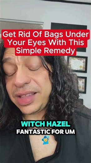 🍃Get Rid Of Bags Under Your Eyes With This Simple Remedy 🍃