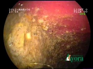 Veterinary endoscopy. Gastric foreign body.
