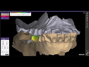 Exocad para PRINCIPIANTES // Diseño de corona monolítica sobre escaneado intra oral
