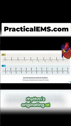 Learn EKG: Junctional Rhythms Explained in Simple Terms #shorts
