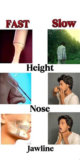 Fast Vs Slow Transformation: Height, Nose & Jawline! 👀 #Shorts