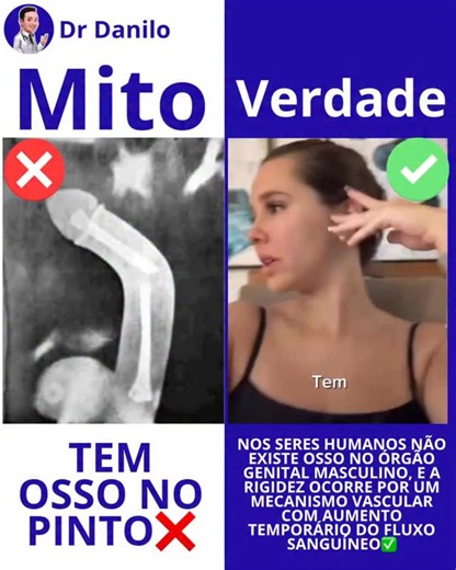 Circula nas redes a ideia de que o órgão genital masculino teria um osso interno responsável pela rigidez. Isso é um mito quando falamos de seres humanos. Diferente de vários mamíferos, o homem não possui estrutura óssea nessa região. A firmeza que ocorre durante a excitação é resultado de um mecanismo vascular, ou seja, aumento do fluxo de sangue em estruturas internas chamadas corpos cavernosos. Durante a estimulação, há liberação de substâncias como o óxido nítrico, que promovem relaxamento d
