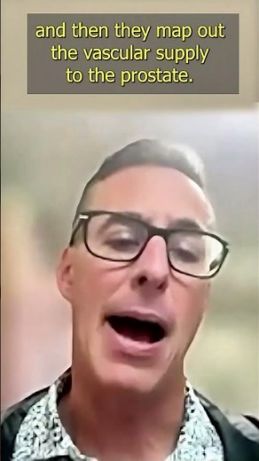 Prostate Artery Embolization - Dr. Brian Helfand | #ActiveSurveillance #ProstateCancer