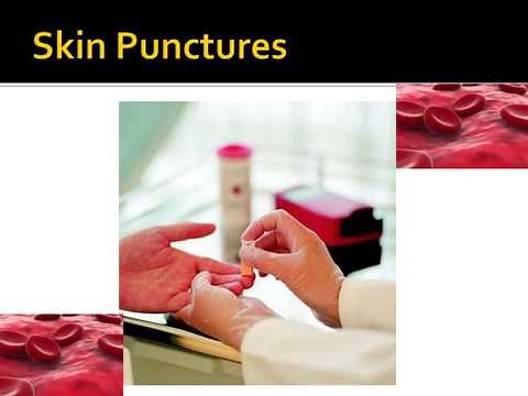 SKIN PUNCTURE PROCEDURES