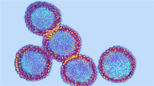 Moderna awarded $590M to help accelerate development of mRNA-based bird flu vaccine: HHS