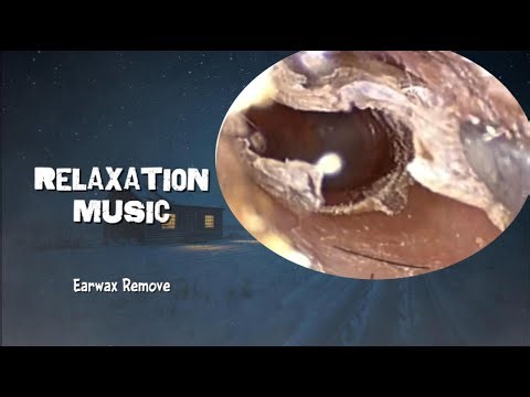 #EarWaxRemoval #EarCleaning #SatisfyingEarCleaning #EarWax #EarWaxRemovalCompilation