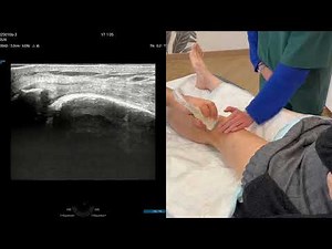 infiltration du genou échoguidée