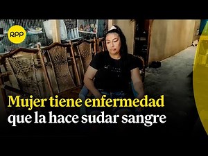 Mujer suda sangre por estrés y denuncia indiferencia de las autoridades | Hematidrosis | Salud