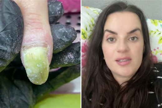 I'm a nail tech & these are some of the worst nails I've seen, they’re green