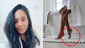 Doctor's warning on why you should scrub your feet regularly