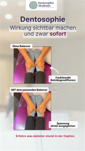 Mehr Wirkung in deiner Praxis | CMD & Myofunktion on Instagram: "Dentosophie wirkt – bis in die Füße. ✨ Oben siehst du den Ausgangszustand: funktionelle Beinlängendifferenz Unten liegt der passende Balancer im Mund: Spannung direkt ausgeglichen 🧠 Der Körper reagiert sofort, weil wir immer den ganzen Körper mitdenken Wir prüfen mit der Posturologie nicht nur den Biss, sondern die Wirkung auf das gesamte System. Hintergrund: 🔄 Über den Biss ist dein Körper über viele Propriozeptoren verbunden. �