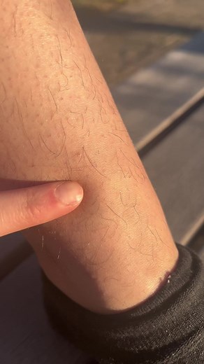 再販や詳しい使い方はインスタグラムで発信しております😊質問コーナーやプレゼント企画も行っておりますので是非フォローお願い致します🤲🏻✨ #smooth #セルフ脱毛 #シュガーリング脱毛