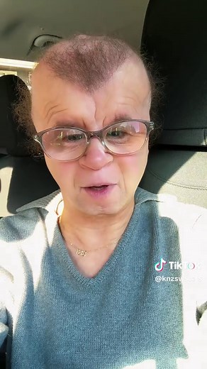 The Journey to Getting Dentures: What to Expect