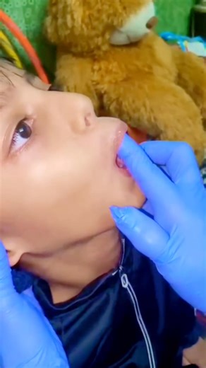 Speech Delay? Try These Oral Motor Exercises|| Speech Therapy Exercises Every Parent Should Know|| Oral–Motor Exercises for Children Oral–motor exercises help strengthen the muscles used for speech, feeding, and swallowing. Benefits: • Strengthens the mouth, lips, cheeks, and tongue • Improves clear speech and sound articulation • Supports feeding, chewing, and swallowing skills • Helps children with speech delay, unclear sounds, or low oral muscle tone 1. Lip Exercises • Improve lip strength an