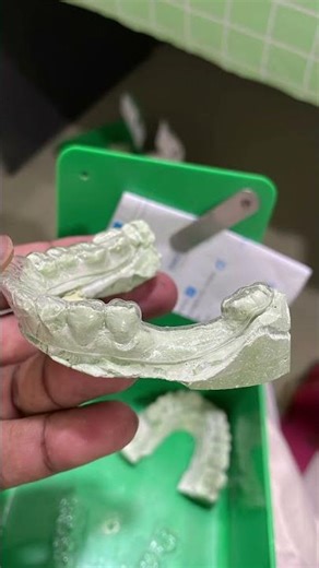 essix retainer #teeth #shorts #shortvideo #short