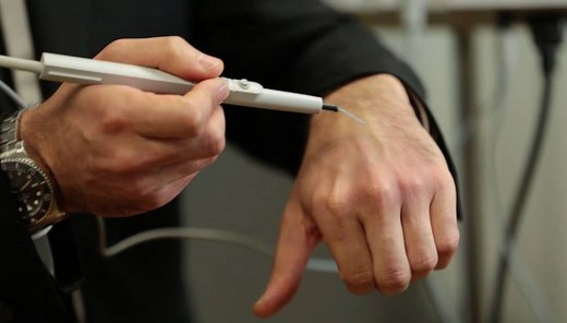 Neurofibromatosis & Electrodesiccation "We can deliver a type of current into the tissues that are responsible for tumor generation in Neurofibromatosis and causes a dehydration of those tissues. It offers the ability for these patients to have hundreds of these tumors treated in one session." #Neurofibromatosis #NeurofibromatosisAwarenessMonth #EndNF #Electrodesiccation | Andre Panossian, MD - Plastic Surgeon