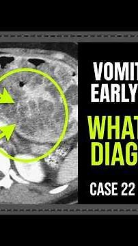 Repeated Vomiting & Early Satiety! | Gastrointestinal Case 22