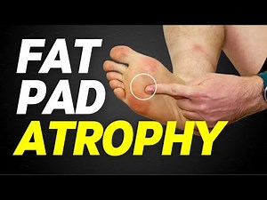 Fat Pad Atrophy - Heel Fad Atrophy and Ball of Foot Atrophy