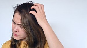 Asian woman scratching her scalp caused of itchy scalp. Dandruff and an inflammatory skin condition called seborrheic dermatitis are the most common causes of itchy scalp.