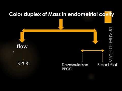 Ultrasound Post partum post abortion hemorrhage