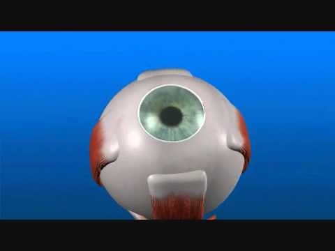 How much does cataract surgery cost in Brisbane? Cataract costs for pensioners