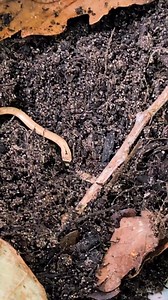 10K views · 111 reactions | One of our tiniest patients this year 缾...