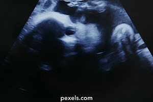 Medical Procedure Videos, Download The BEST Free 4k Stock Video Footage & Medical Procedure HD Video Clips