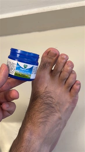 I used Vicks and this! Nail fungus gone!! | Tips and Recipes