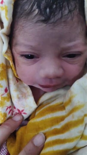 #At Birth #ytshorts #trending #care #love #baby #cutebaby #breastfeeding #viral #viralshorts